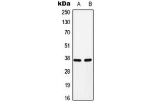 Western blot analysis of C/EBP alpha (pS193) expression in H9C2 (A), Raw264. (CEBPA Antikörper  (pSer193))