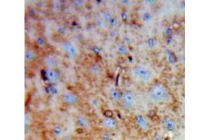 Used in DAB staining on fromalin fixed paraffin-embedded Brain tissue (DPYSL3 Antikörper  (AA 1-218))