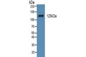 Western Blotting (WB) image for Platelet Derived Growth Factor Receptor alpha (PDGFRA) ELISA Kit (ABIN6720580)