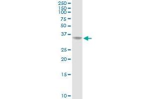 AKR1C2 MaxPab rabbit polyclonal antibody. (AKR1C2 Antikörper  (AA 1-323))