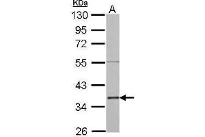 WB Image Annexin II antibody detects ANXA2 protein by Western blot analysis. (Annexin A2 Antikörper)