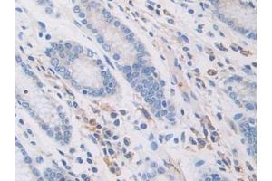 Figure. (PZP Antikörper  (AA 1212-1391))