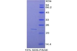 SDS-PAGE analysis of Mouse Sulfite Oxidase Protein. (SUOX Protein)