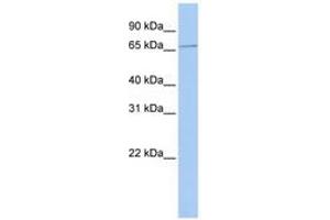 Image no. 1 for anti-Sex Comb On Midleg Homolog 1 (SCMH1) (AA 180-229) antibody (ABIN6740271)
