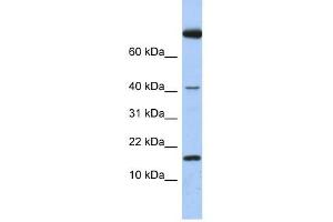 IL4 antibody used at 1 ug/ml to detect target protein. (IL-4 Antikörper  (Middle Region))