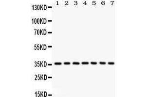 Western Blotting (WB) image for anti-Nuclear Factor of kappa Light Polypeptide Gene Enhancer in B-Cells Inhibitor, alpha (NFKBIA) (AA 3-112) antibody (ABIN3043889) (NFKBIA Antikörper  (AA 3-112))