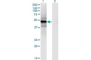 Western Blot analysis of SLC25A25 expression in transfected 293T cell line by SLC25A25 monoclonal antibody (M02), clone 4D8.