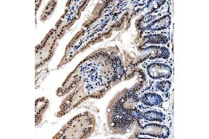 IHC analysis of SNRNP200 using anti-SNRNP200 antibody (ABIN7602032). (SNRNP200 Antikörper  (AA 557-2129))