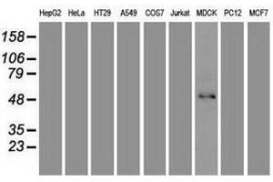 Image no. 2 for anti-Forkhead Box A1 (FOXA1) (AA 1-473) antibody (ABIN1490773) (FOXA1 Antikörper  (AA 1-473))