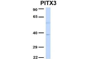 Host:  Rabbit  Target Name:  PITX3  Sample Type:  Human Fetal Liver  Antibody Dilution:  1.