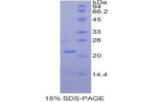 SDS-PAGE analysis of Human GaA Protein. (GAA Protein)