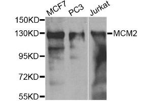 Western blot analysis of extracts of various cell lines, using MCM2 antibody. (MCM2 Antikörper)