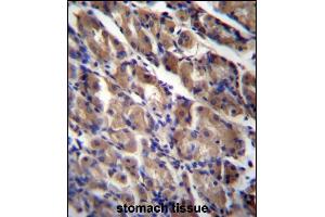 ABRA Antibody (C-term) (ABIN656755 and ABIN2845977) immunohistochemistry analysis in formalin fixed and paraffin embedded human stomach tissue followed by peroxidase conjugation of the secondary antibody and DAB staining. (ABRA Antikörper  (C-Term))