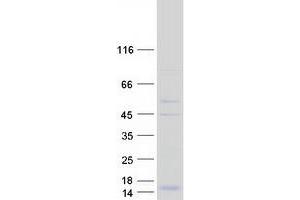 Validation with Western Blot (HCST Protein (Transcript Variant 2) (Myc-DYKDDDDK Tag))