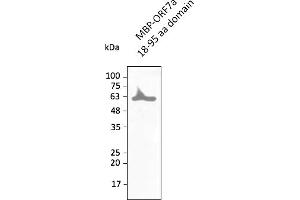 Western Blotting (WB) image for anti-SARS-CoV-2 ORF7a antibody (ABIN7272994) (SARS-CoV-2 ORF7a Antikörper)