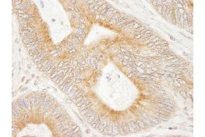 anti-Microtubule-Associated Protein 7 (MAP7) (AA 150-200) antibody