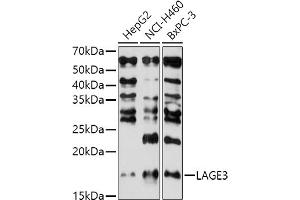 Western blot analysis of extracts of various cell lines, using L antibody (ABIN7268159) at 1:1000 dilution. (LAGE3 Antikörper  (AA 1-143))