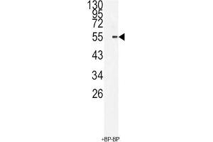 Western Blotting (WB) image for anti-BMI1 Polycomb Ring Finger Oncogene (BMI1) antibody (ABIN3001536) (BMI1 Antikörper)