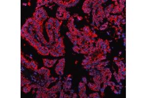 IF analysis of PDK2 using anti-PDK2 antibody (ABIN5693279). (PDK2 Antikörper  (AA 81-177))