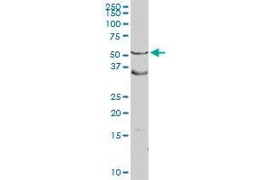 ASL MaxPab rabbit polyclonal antibody. (ASL Antikörper  (AA 1-464))