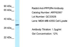 Western Blotting (WB) image for anti-Protein Phosphatase 2A Activator, Regulatory Subunit 4 (PPP2R4) (N-Term) antibody (ABIN2789005) (PPP2R4 Antikörper  (N-Term))