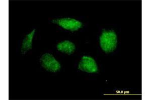 Immunofluorescence of purified MaxPab antibody to HOXB1 on HeLa cell. (HOXB1 Antikörper  (AA 1-235))
