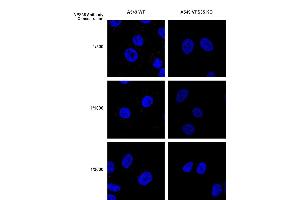 Immunocytochemistry/Immunofluorescence analysis using Mouse Anti-VPS35 Monoclonal Antibody, Clone 10A8 (ABIN6933002). (VPS35 Antikörper  (PE))