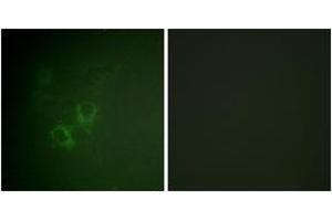 Immunofluorescence analysis of HeLa cells, using AhR (Ab-36) Antibody. (Aryl Hydrocarbon Receptor Antikörper  (AA 2-51))