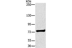 Western blot analysis of K562 cell, using HSD17B4 Polyclonal Antibody at dilution of 1:400 (HSD17B4 Antikörper)