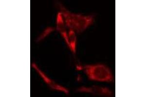 ABIN6275647 staining NIH-3T3 cells by IF/ICC. (PEAK1 Antikörper  (Internal Region))
