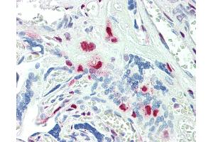 Anti-KLF16 antibody IHC staining of human placenta. (KLF16 Antikörper  (AA 239-252))