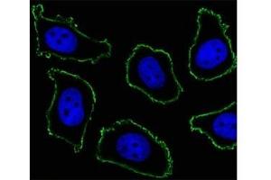 Fluorescent image of A549 cell stained with CD33 antibody at 1:25. (CD33 Antikörper  (AA 337-364))