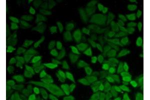 Figure:FITC staining on IHC-P Simple: Hela cells