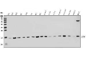 Western blot analysis of LSM8 using anti-LSM8 antibody (ABIN7599579). (NAA38 Antikörper  (AA 1-96))