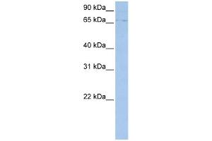 WB Suggested Anti-ABCF3 Antibody Titration:  0. (ABCF3 Antikörper  (N-Term))