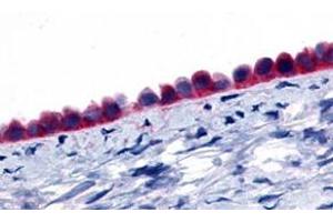 Immunohistochemistry (Formalin/PFA-fixed paraffin-embedded sections) of human ovary, epithelium with GPR133 polyclonal antibody . (G Protein-Coupled Receptor 133 Antikörper  (Extracellular Domain))