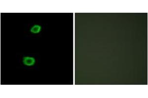Immunofluorescence analysis of HepG2 cells, using LMTK2 Antibody.