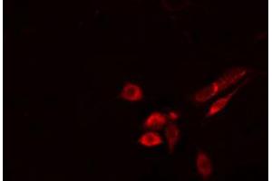 ABIN6274514 staining Hela cells by IF/ICC. (FKRP Antikörper  (N-Term))