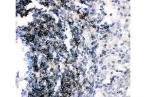 IHC-P: CD79b antibody testing of human tonsil tissue (CD79b Antikörper  (AA 29-229))