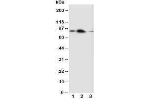 Western blot testing of APLP2 antibody and Lane 1:  rat brain;  2: rat heart;  3: human SMMC-7721 cell lysate (APLP2 Antikörper  (C-Term))