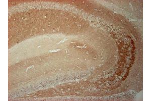 Immunohistochemistry (Paraffin-embedded Sections) (IHC (p)) image for anti-N-Ethylmaleimide-Sensitive Factor (NSF) antibody (ABIN1742269)
