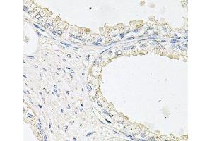 Immunohistochemistry of paraffin-embedded Human prostate using EPOR Polyclonal Antibody at dilution of 1:100 (40x lens). (EPOR Antikörper)