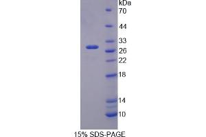 Image no. 1 for Nitric Oxide Synthase 1 (Neuronal) Adaptor Protein (NOS1AP) (AA 19-251) protein (His tag) (ABIN6238403) (NOS1AP Protein (AA 19-251) (His tag))