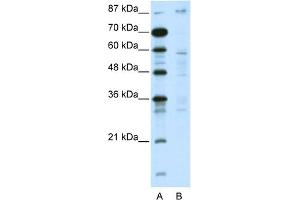 WB Suggested Anti-DMAP1 Antibody Titration:  5. (DMAP1 Antikörper  (C-Term))