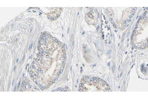 ABIN6272978 at 1/100 staining Human prostate tissue by IHC-P. (PYGL Antikörper  (Internal Region))