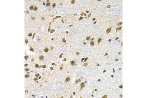 Immunohistochemistry of paraffin-embedded rat brain using LBR antibody at dilution of 1:200 (40x lens). (Lamin B Receptor Antikörper)