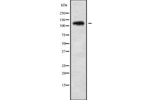 Western blot analysis UBE4A using HepG2 whole cell lysates (UBE4A Antikörper  (C-Term))