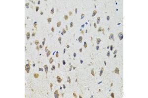 Immunohistochemistry of paraffin-embedded mouse brain using CYP19A1 antibody (ABIN5971188) at dilution of 1/100 (40x lens). (Aromatase Antikörper)