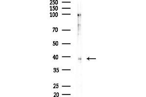 anti-Endophilin-A1 (SH3G2) (Internal Region) antibody