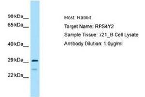 Image no. 1 for anti-Ribosomal Protein S4, Y-Linked 2 (RPS4Y2) (C-Term) antibody (ABIN6749892)